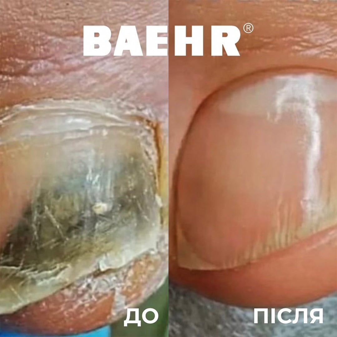 BAEHR Pedibaehr Antifungal agent for feet 30 ml Mythol Forte - Image 3